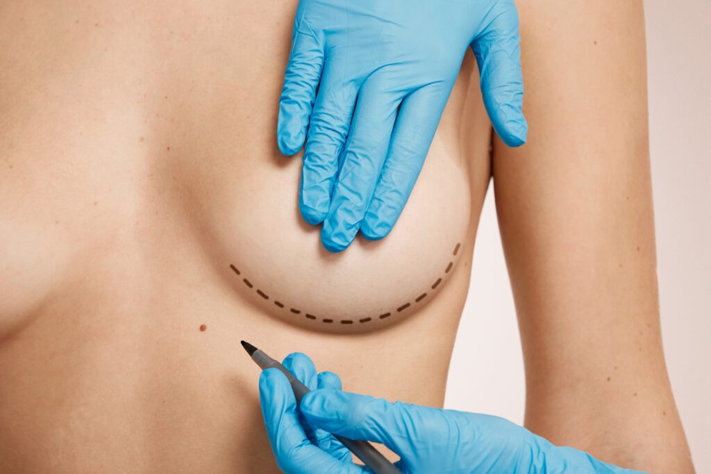 chirurgie esthétique mammaire